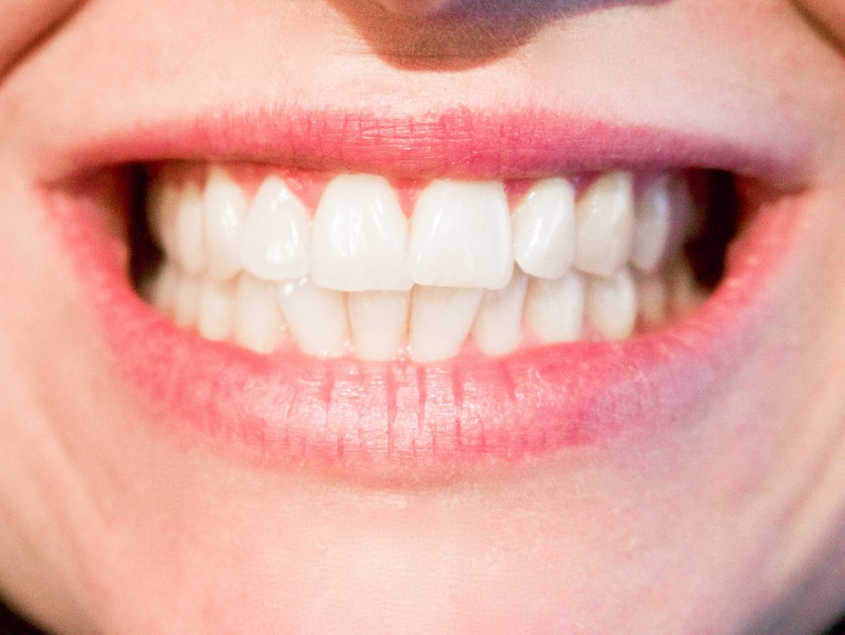 Nowoczesna technika używana w salonach stomatologii estetycznej być może spowodować, że odzyskamy prześliczny uśmiech.